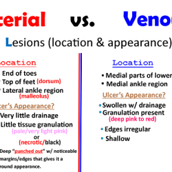 Nclex questions peripheral arterial disease