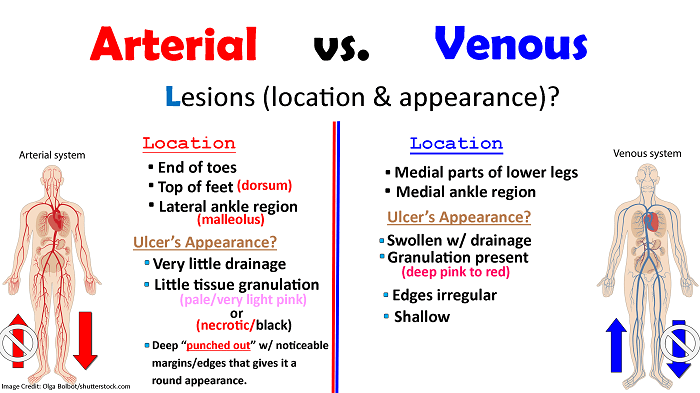 Nclex questions peripheral arterial disease